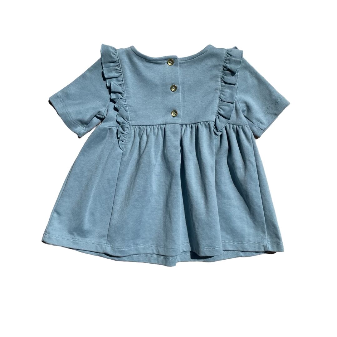 Rachel Zoe Dress, 1